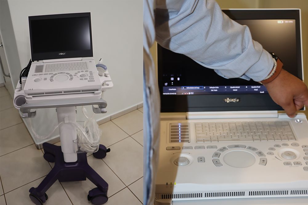 Thermas Social doa aparelho de ultrassom portátil à Santa Casa de Olímpia e reforça parceria em prol da saúde da população